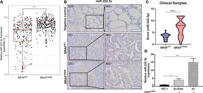 BRAFV600E Mutation-Responsive miRNA-222-3p Promotes Metastasis of Papillary Thyroid Cancer Cells via Snail-Induced EMT